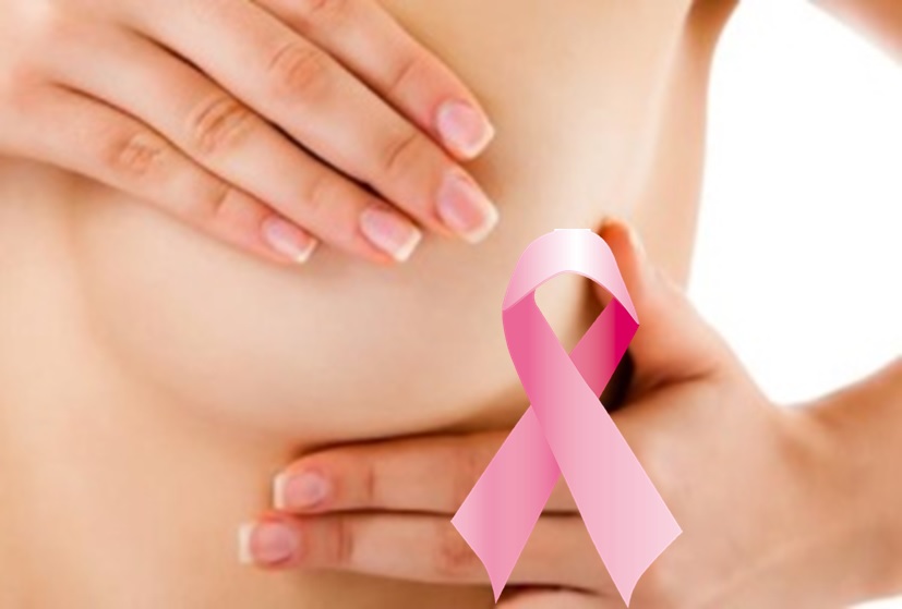 乳がんを予防する食とライフスタイル10の戦略